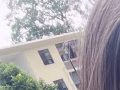 打瘦脸针去皱针200