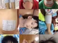 精油贴布