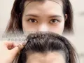 能长出头发的发际线即刻 懂的来！