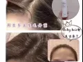 韩国专利技术草本配方养发液【改善掉发，纯绿色有机草本植物提取解决脱发】