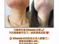 韓國優質多彩維他命C粉【幫助保護心臟，保護皮膚，防止衰老】