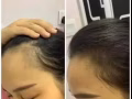 秃头❓脱发❓头皮问题❓【纯天然养发剂，天然不刺激，无副作用】