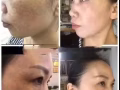 韩式微整圣诞大促销了