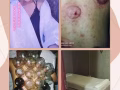 小米专业按摩