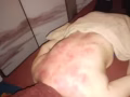推拿按摩