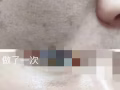 美容祛斑效果杠杠滴
