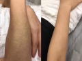 永久性永毛、胸部、手臂、腿部、腋下、比基尼、纹眉、纹唇