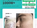 我是Carleen是专业祛斑痘黄修护的行家随时联络Whatsapp81852768微信Carleen141319