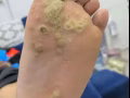 專業修腳